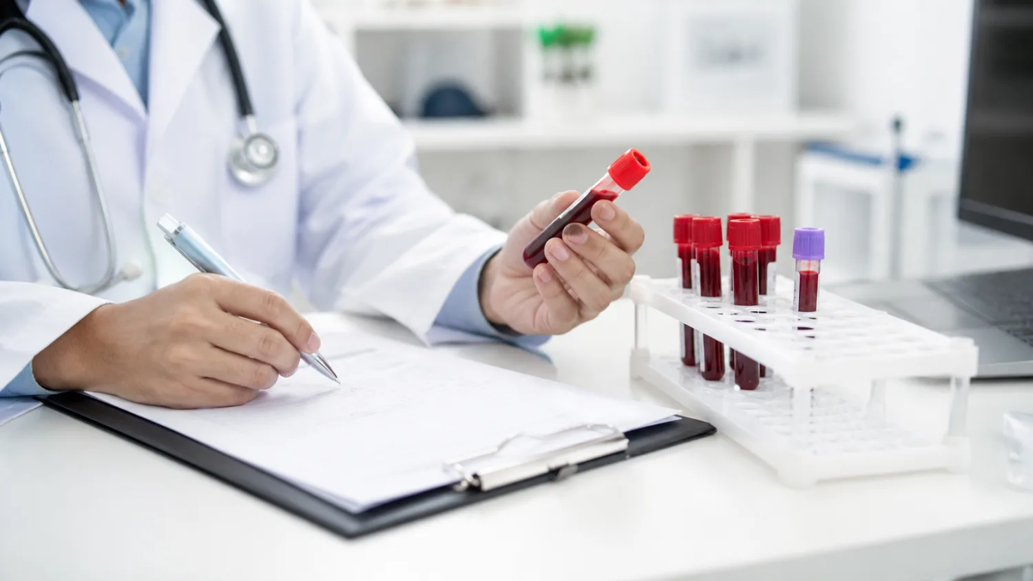 Vitamino B12 ir folio rūgšties tyrimai: ką reiškia maži, ribiniai ar pakitę rezultatai